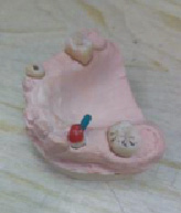 kostr2.tif