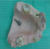 kostr3.tif